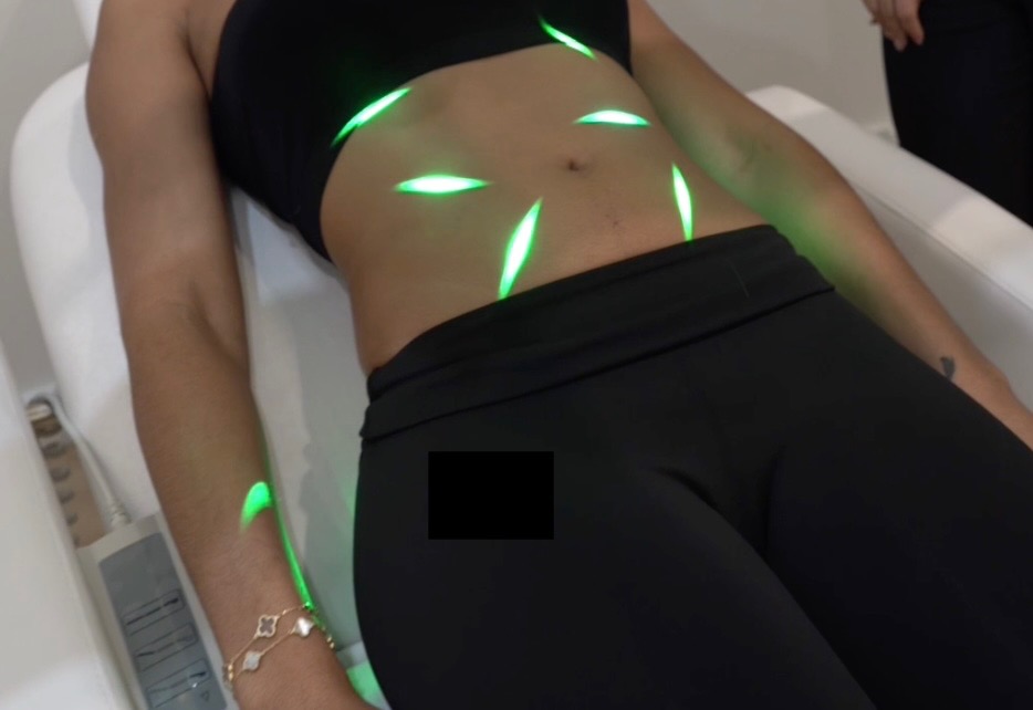 Light Lipo
